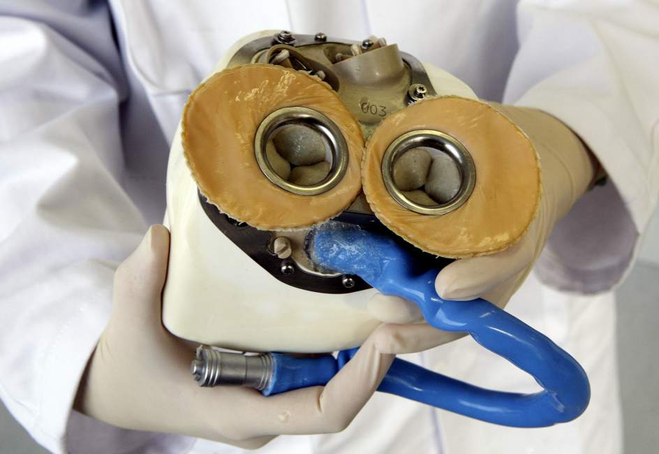 Realizan médicos mexicanos primer implante de corazón artificial