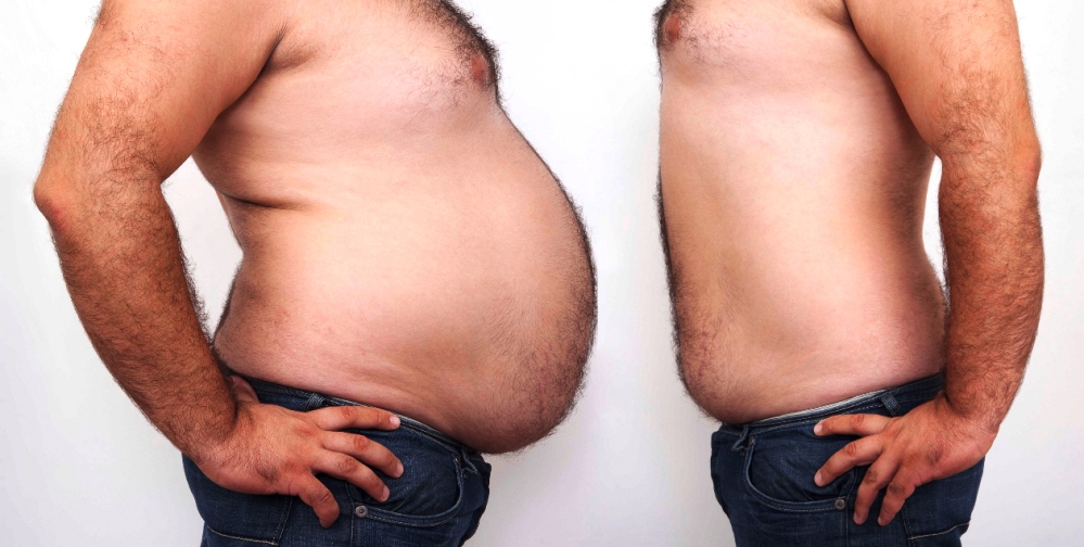 Si bajas de peso y vas al psicólogo, Hacienda te devolverá impuestos